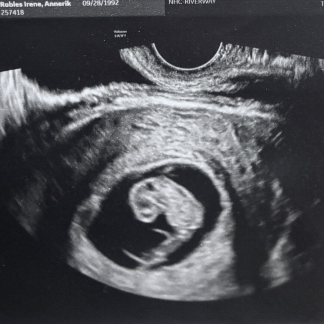 Photo shared by Annerik for their Babylist baby registry.