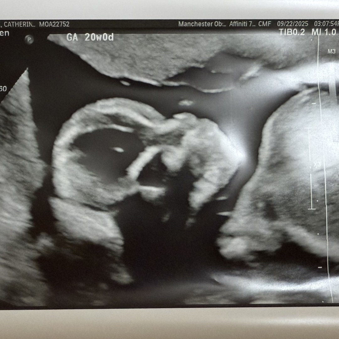 Photo shared by Catherine for their Babylist baby registry.