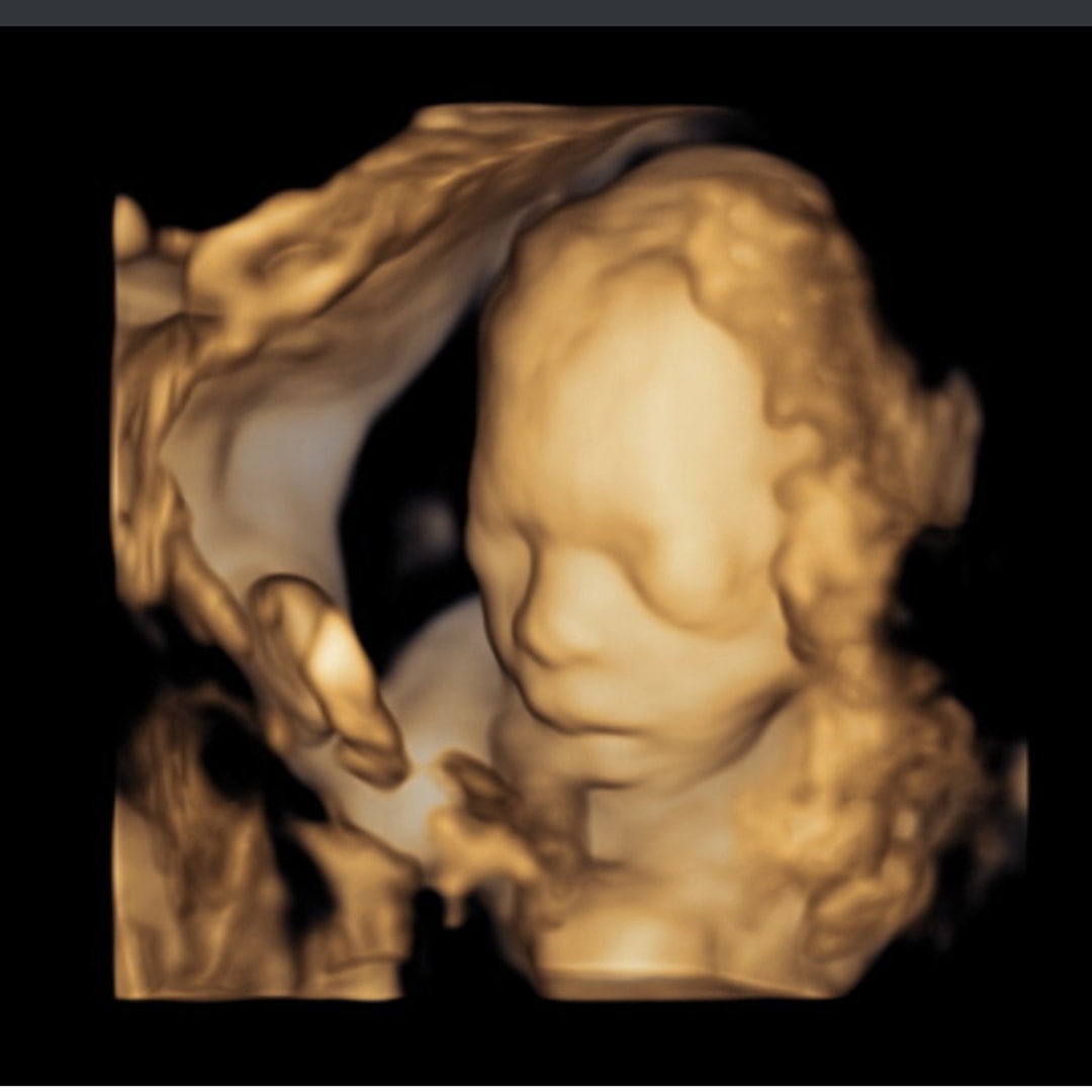 Photo shared by Lexi for their Babylist baby registry.