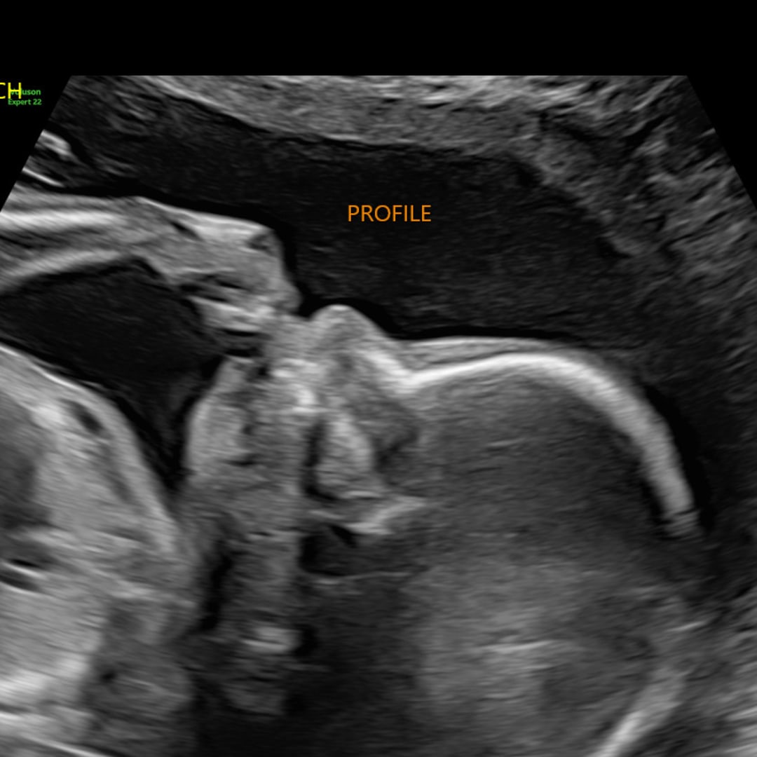 Photo shared by Alexis for their Babylist baby registry.