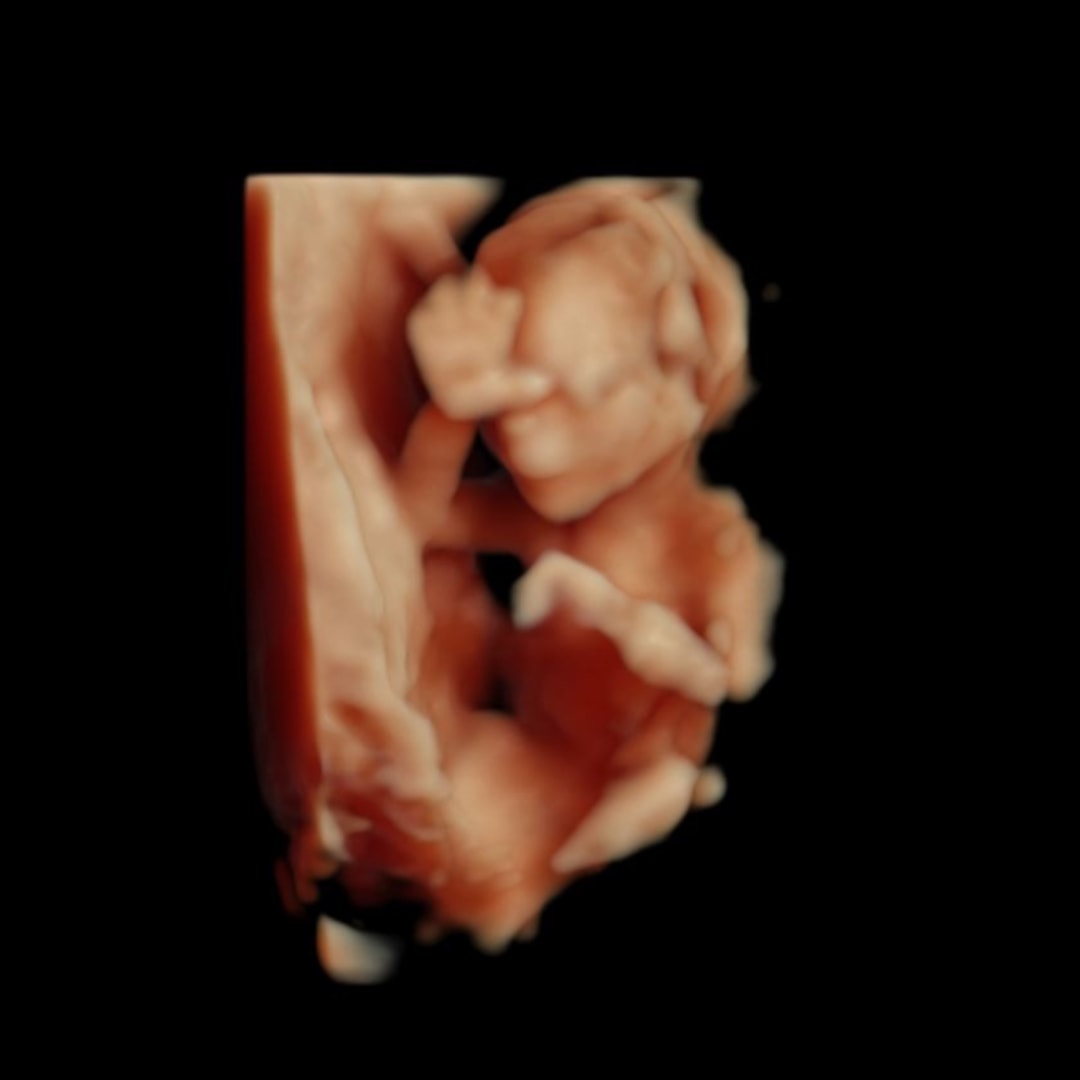 Photo shared by Cha’Mariah for their Babylist baby registry.