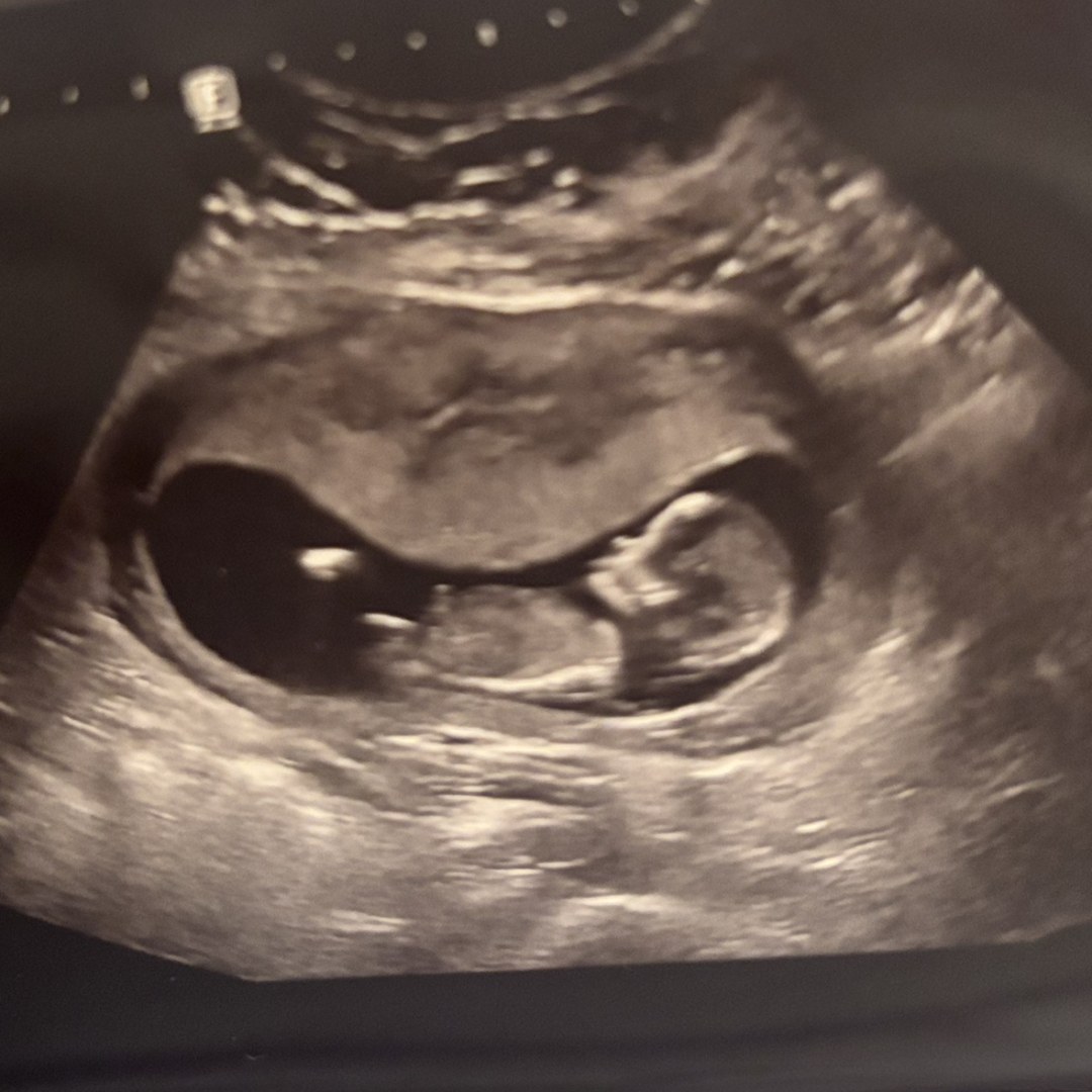 Photo shared by Vivilee for their Babylist baby registry.