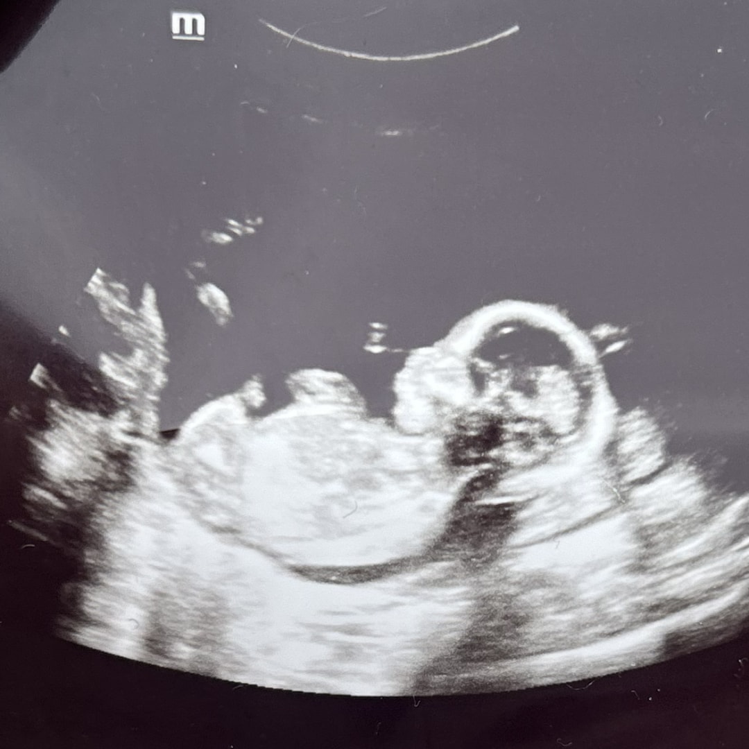 Photo shared by Gabriella for their Babylist baby registry.