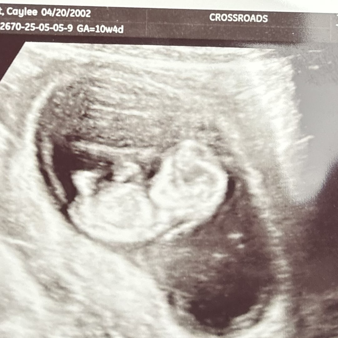 Photo shared by Caylee for their Babylist baby registry.