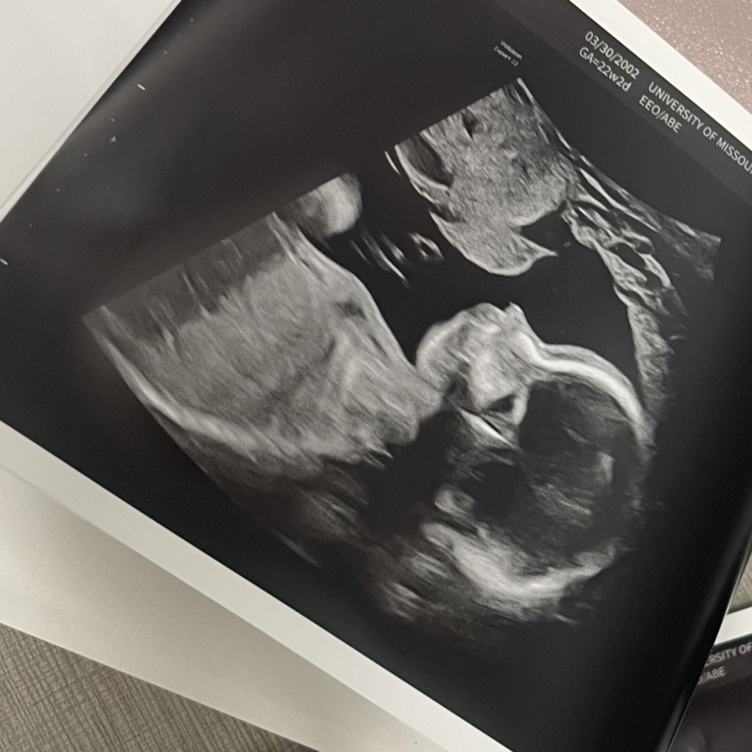 Photo shared by Taylor for their Babylist baby registry.