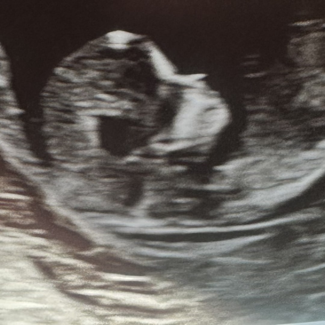 Photo shared by Hayley for their Babylist baby registry.