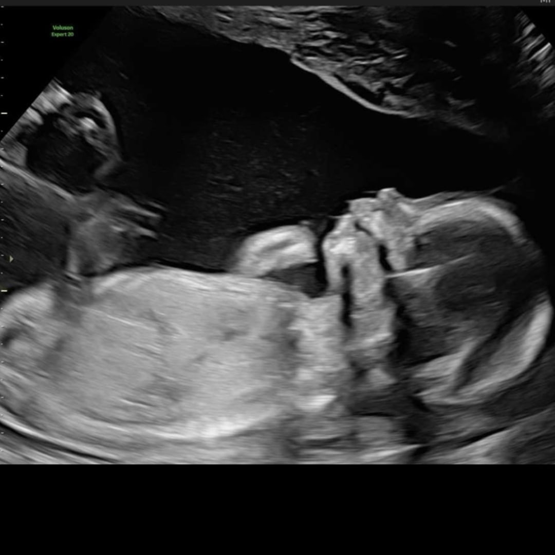 Photo shared by Christie for their Babylist baby registry.