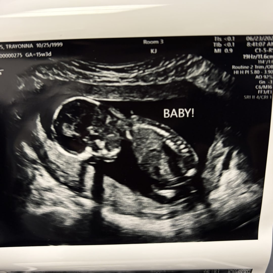 Photo shared by Trayonna for their Babylist baby registry.