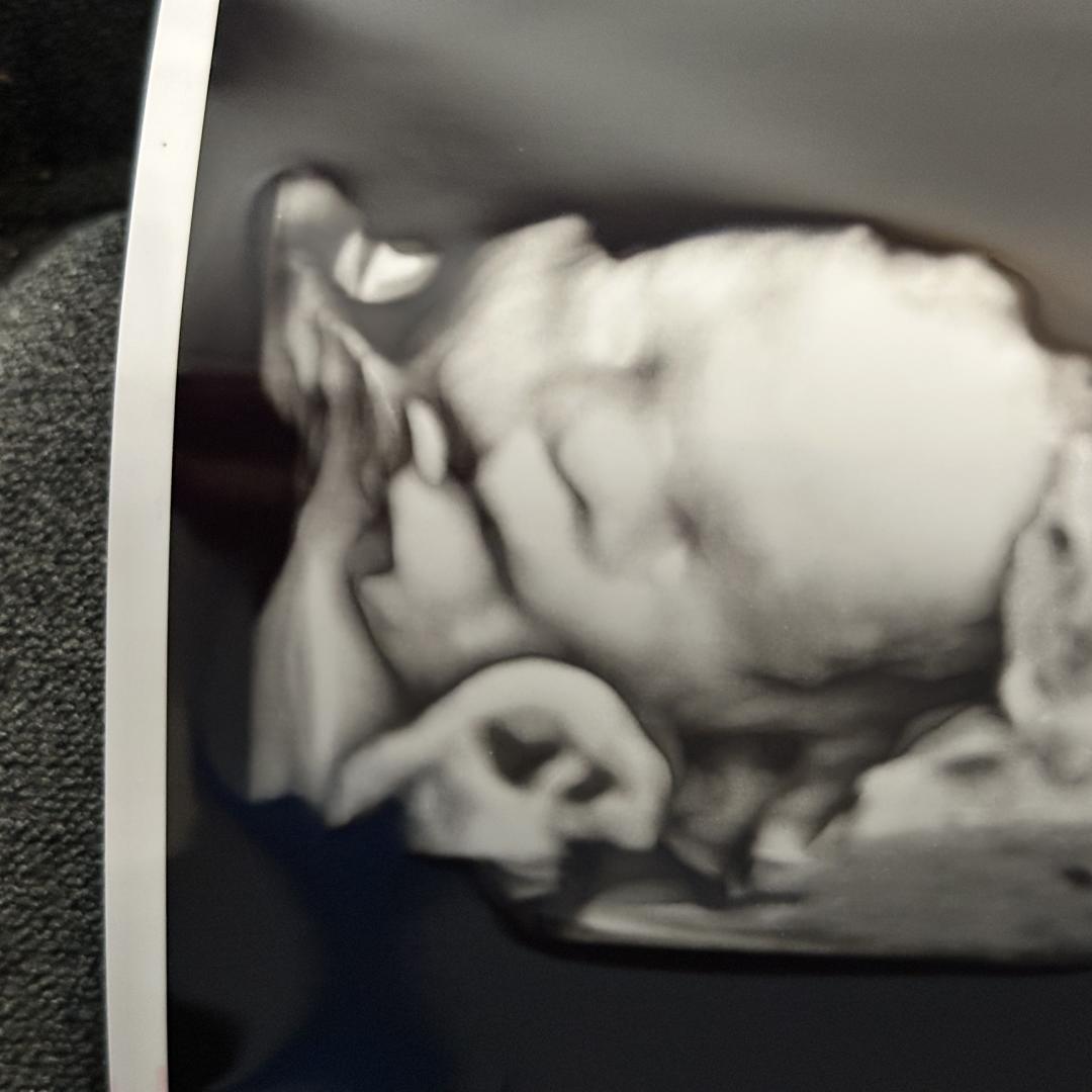 Photo shared by Caitlin for their Babylist baby registry.