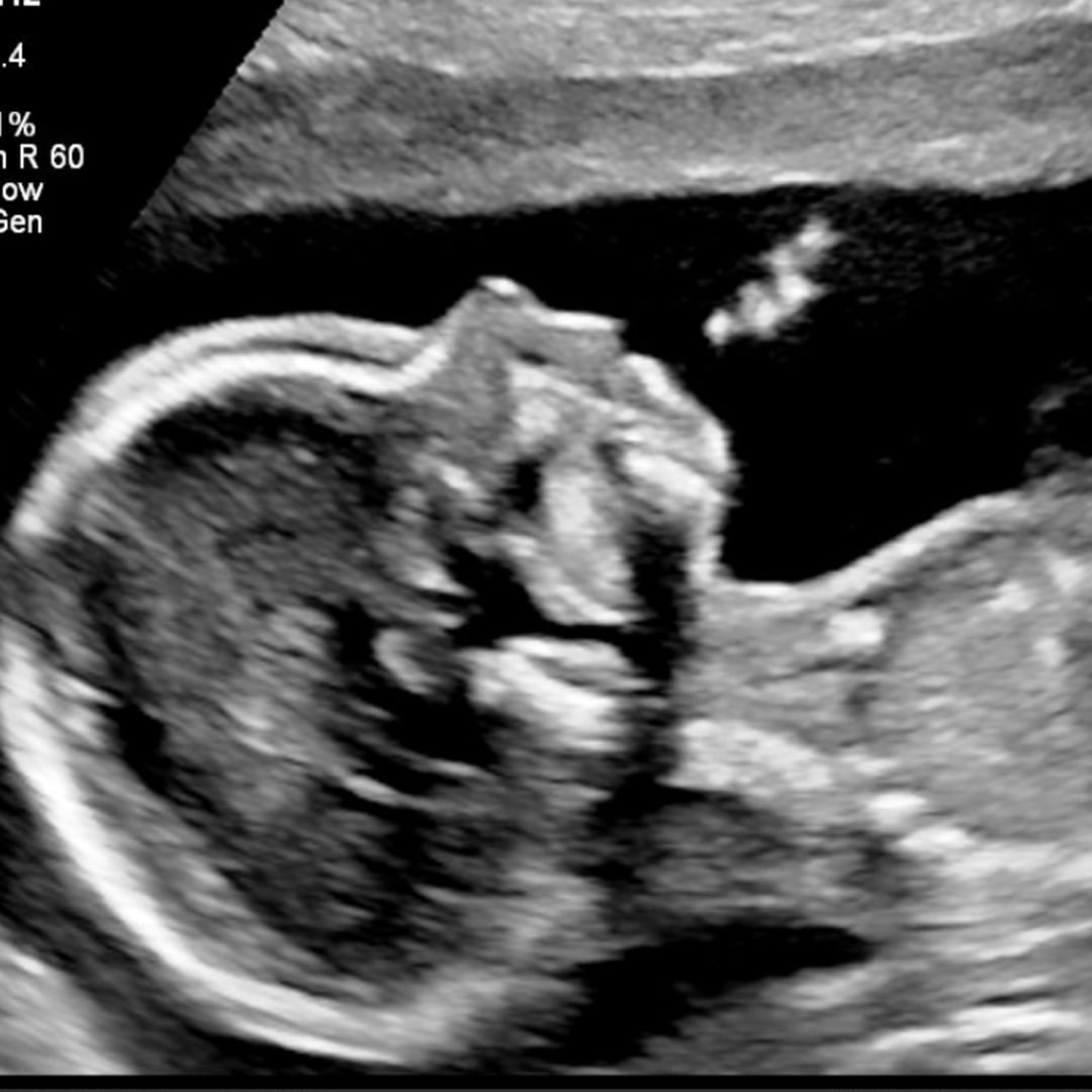 Photo shared by Bianca for their Babylist baby registry.