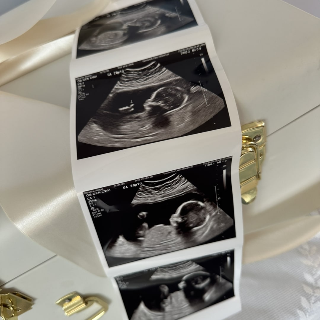 Photo shared by Abigail for their Babylist baby registry.