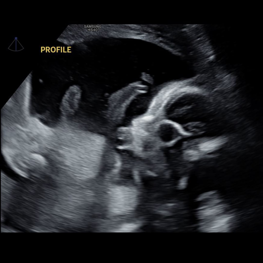 Photo shared by Allyson for their Babylist baby registry.