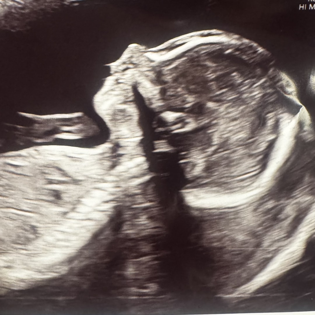 Photo shared by Savannah for their Babylist baby registry.
