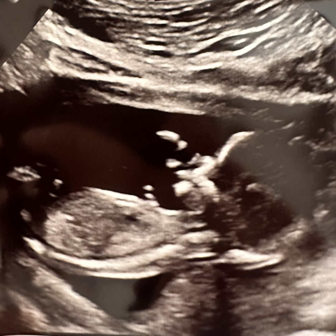 Photo shared by Elise for their Babylist baby registry.