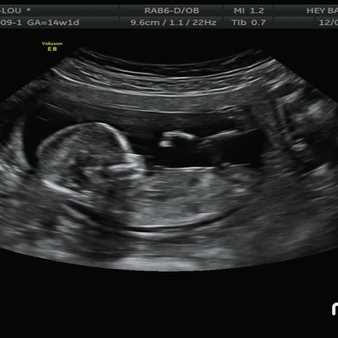 Photo shared by Lexi-Lou for their Babylist baby registry.