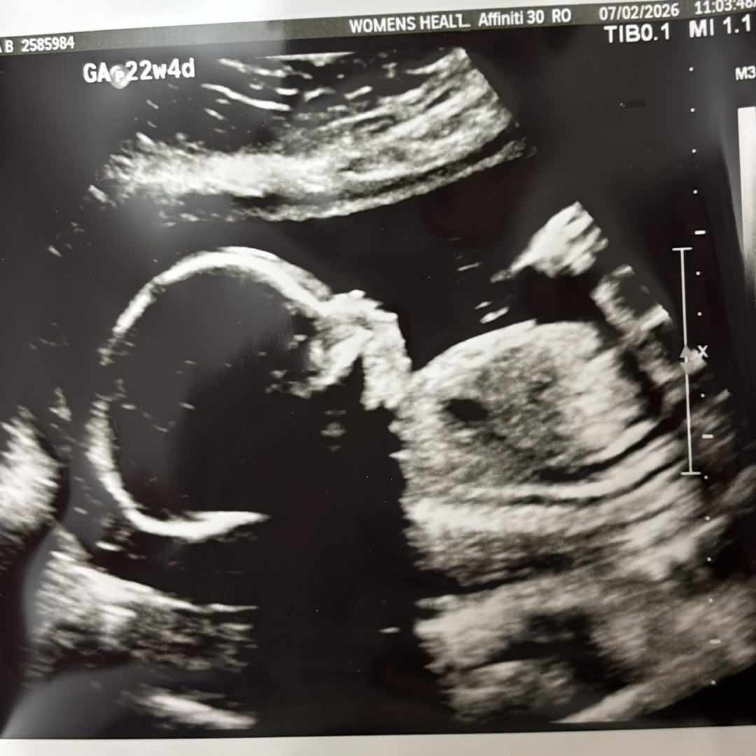 Photo shared by Daniela for their Babylist baby registry.
