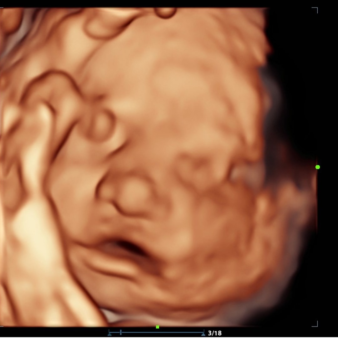 Photo shared by Kimberly for their Babylist baby registry.