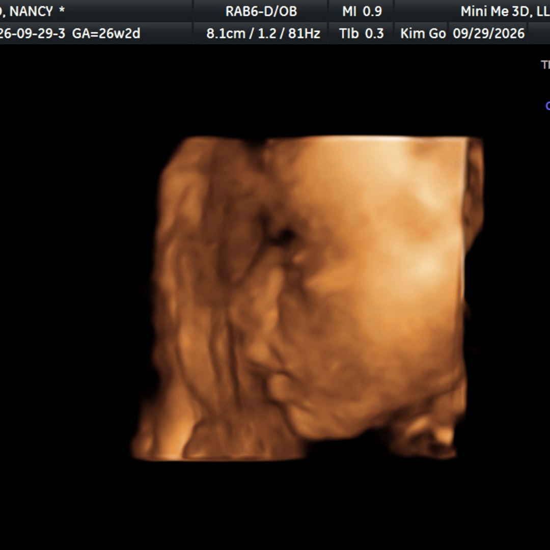 Photo shared by Nancy for their Babylist baby registry.