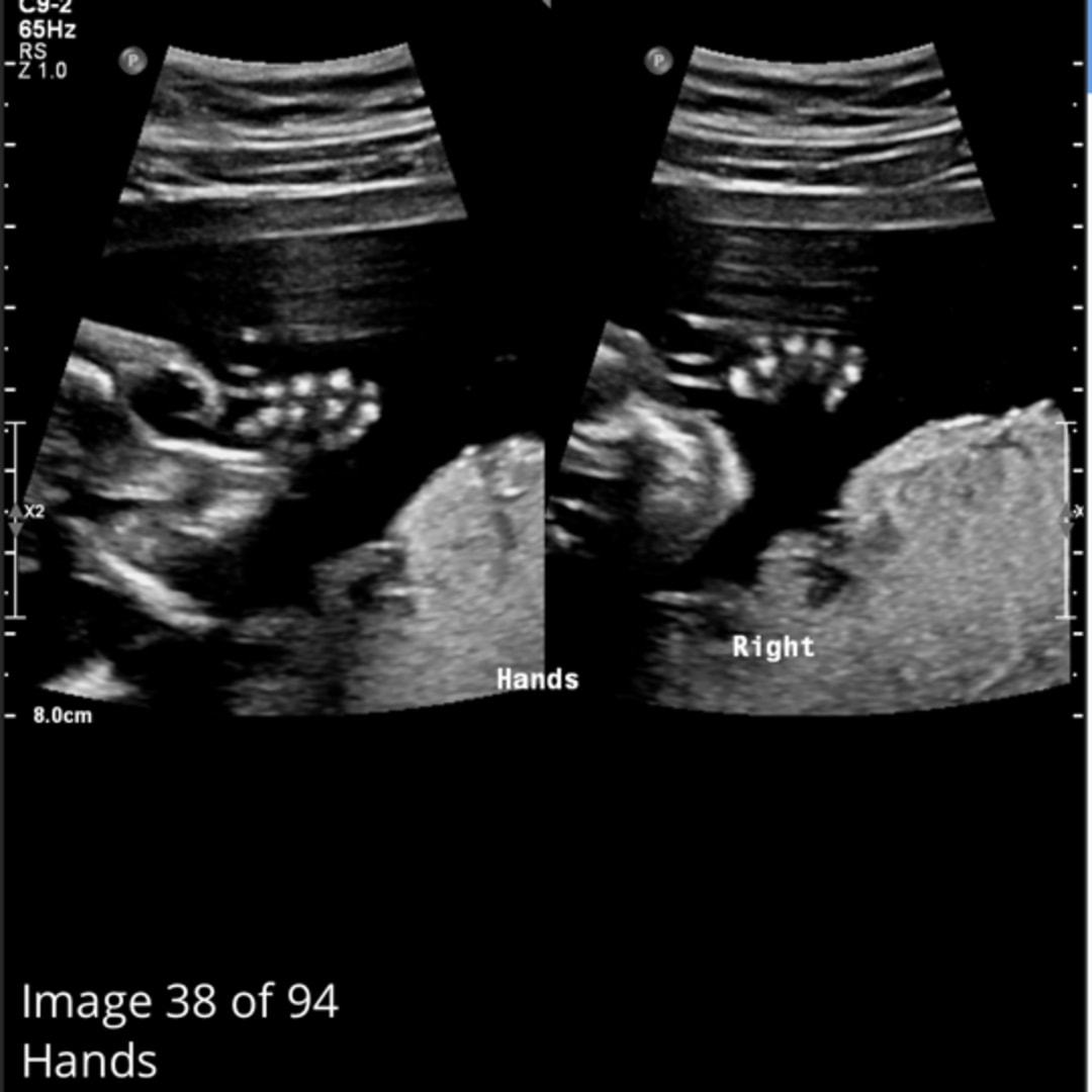 Photo shared by Haelie for their Babylist baby registry.