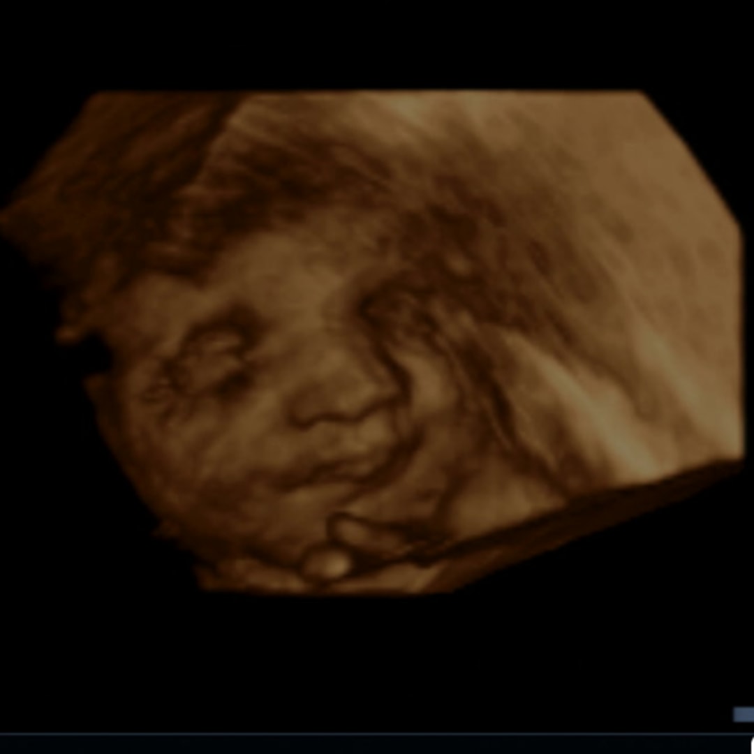 Photo shared by Abby for their Babylist baby registry.