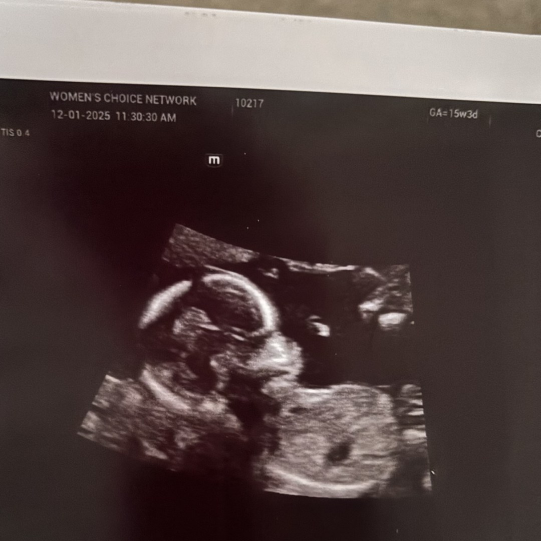 Photo shared by Jianna for their Babylist baby registry.