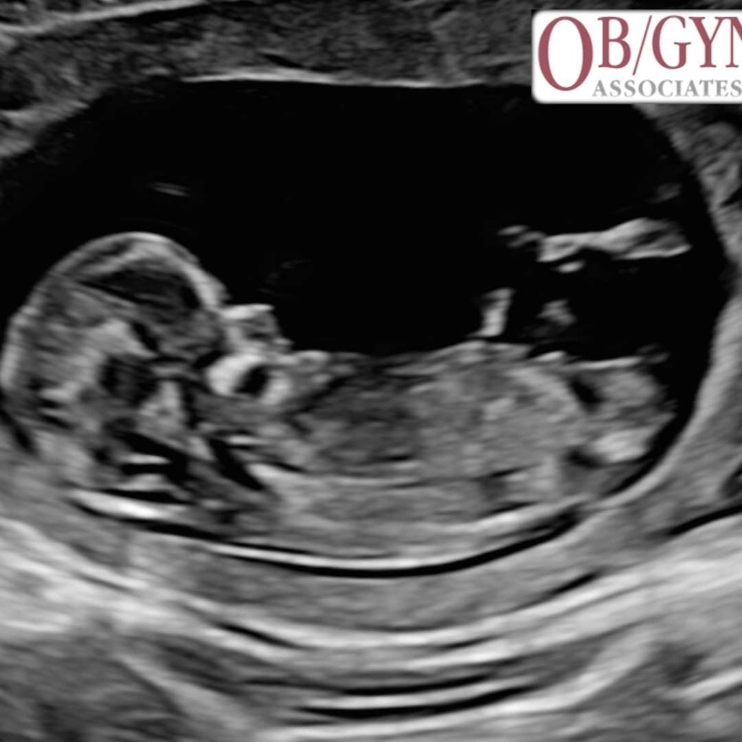 Photo shared by Autumn for their Babylist baby registry.