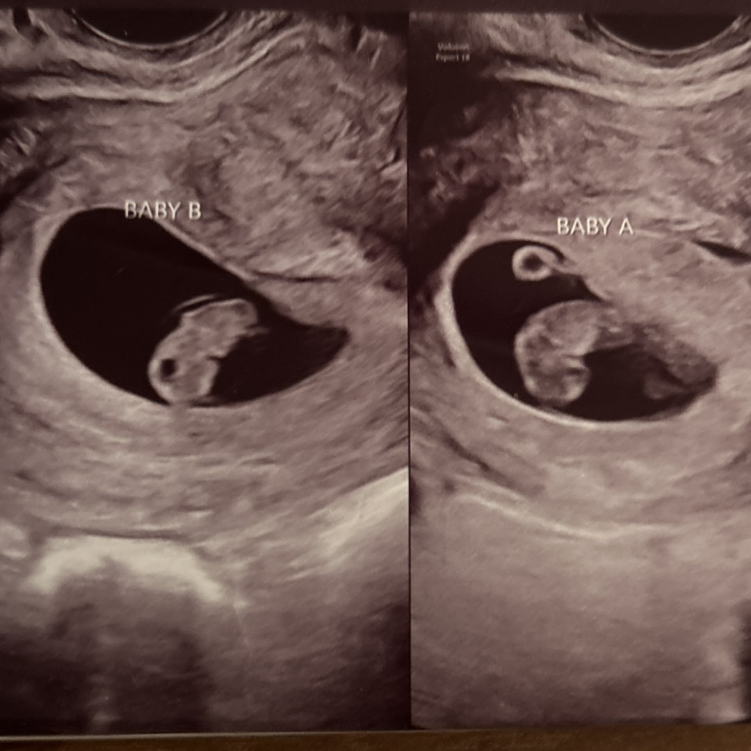 Photo shared by Ashley for their Babylist baby registry.