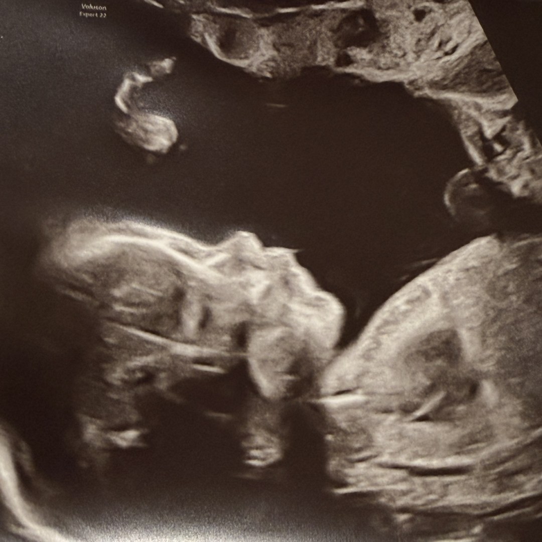 Photo shared by Daniella for their Babylist baby registry.