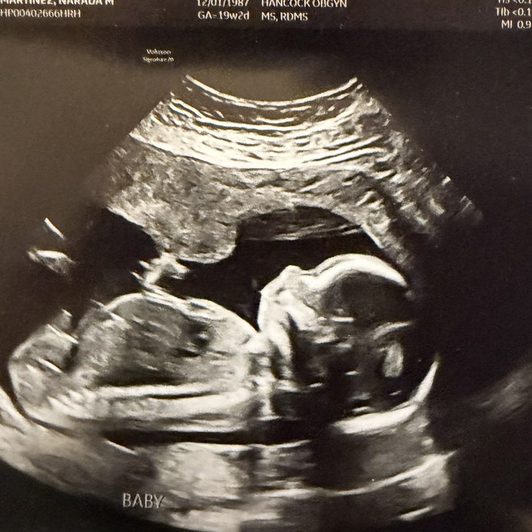 Photo shared by Naradah for their Babylist baby registry.