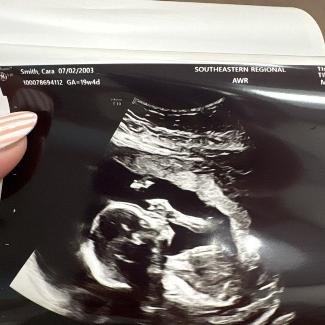 Photo shared by Cara Beth for their Babylist baby registry.