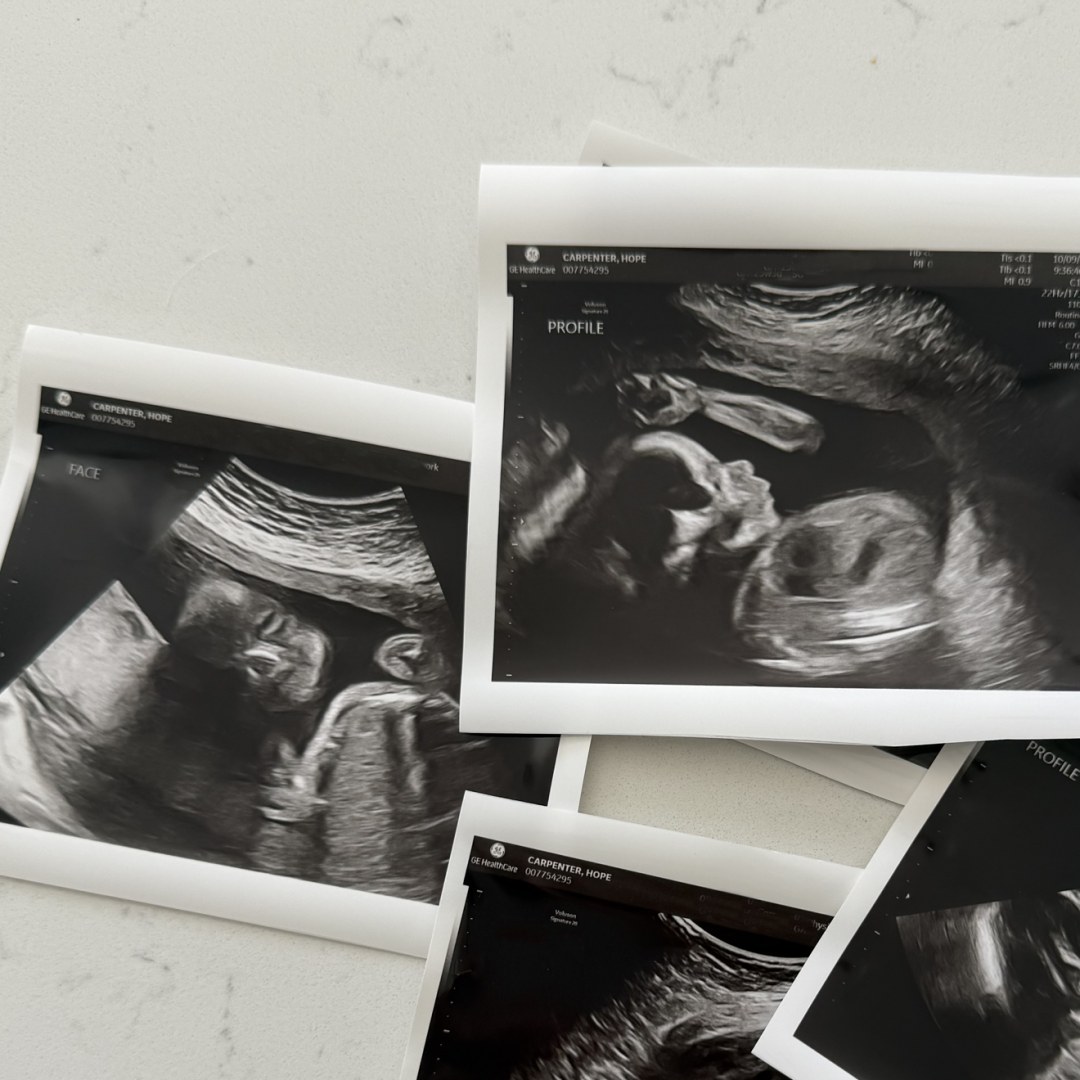 Photo shared by Hope for their Babylist baby registry.