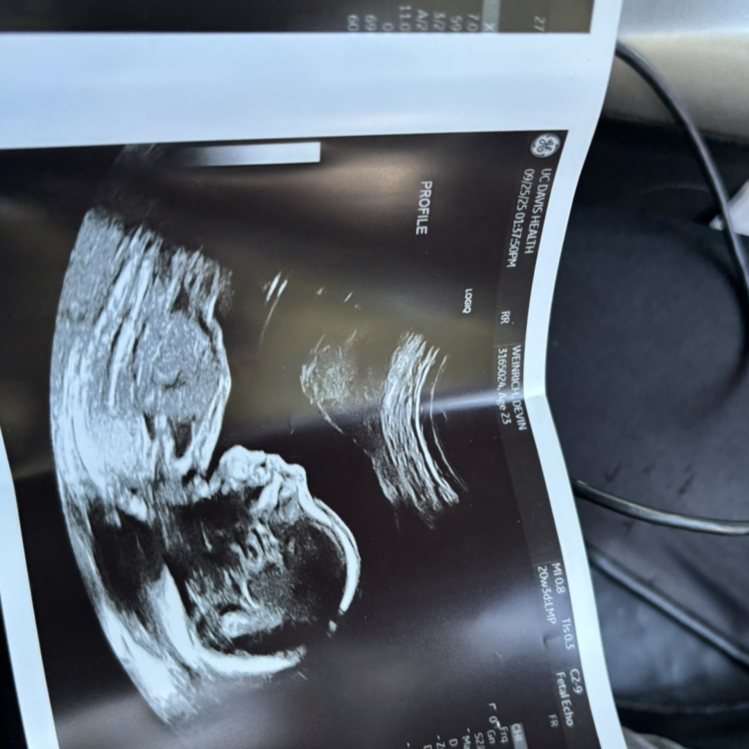 Photo shared by Devin for their Babylist baby registry.