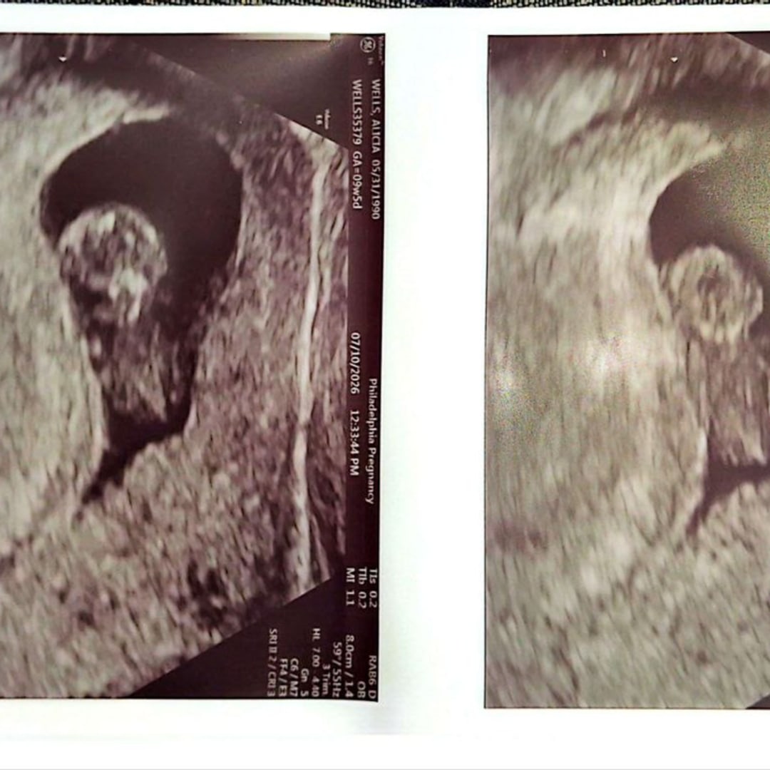 Photo shared by Alicia for their Babylist baby registry.