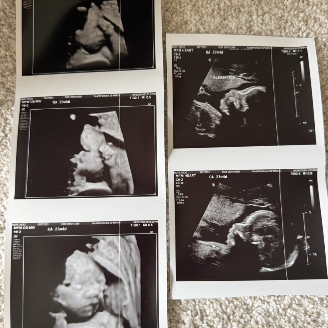 Photo shared by Victoria for their Babylist baby registry.