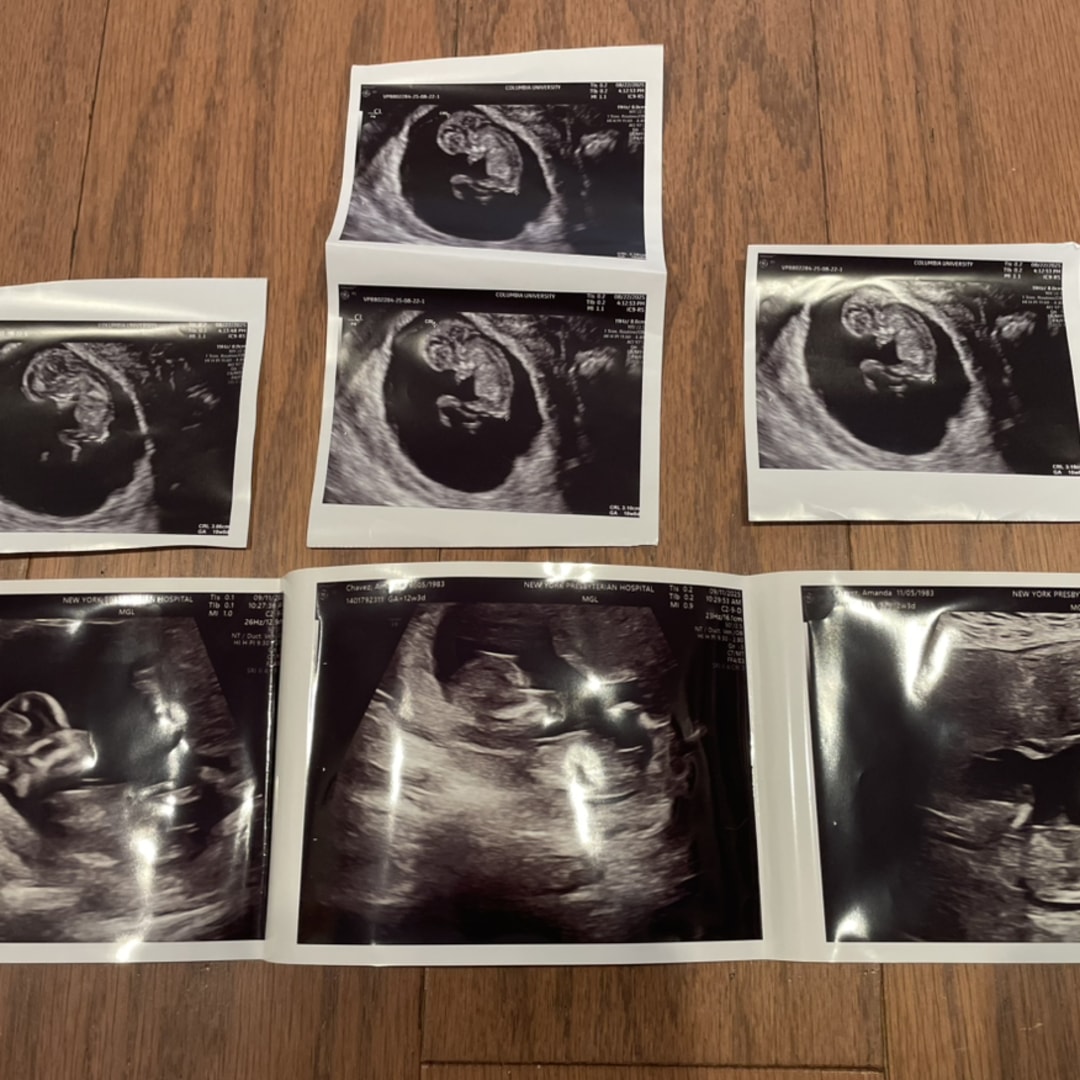 Photo shared by Amanda for their Babylist baby registry.