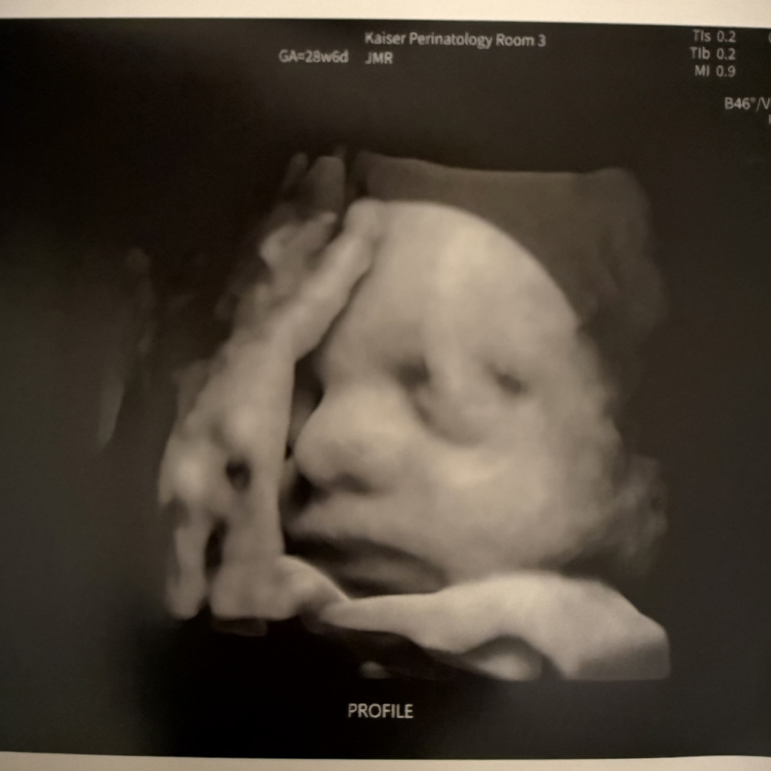 Photo shared by Amanda for their Babylist baby registry.