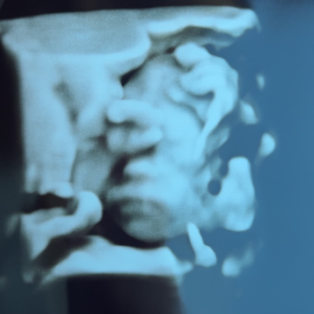 Photo shared by Shea for their Babylist baby registry.