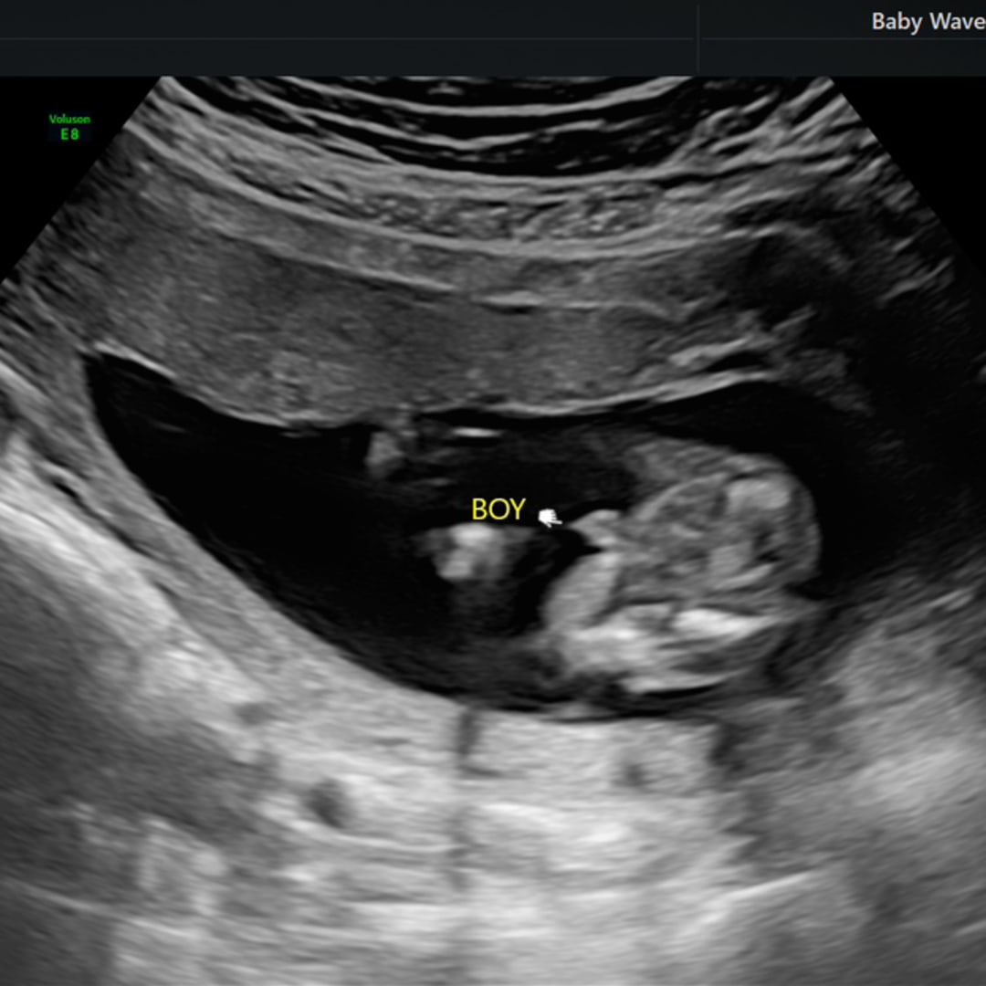 Photo shared by Isabella for their Babylist baby registry.