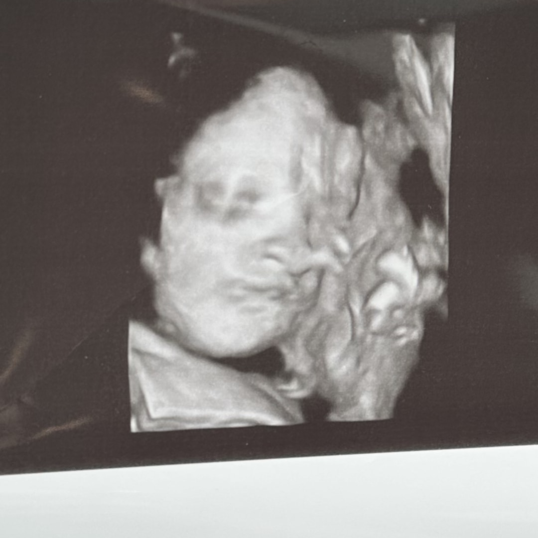Photo shared by Emily for their Babylist baby registry.