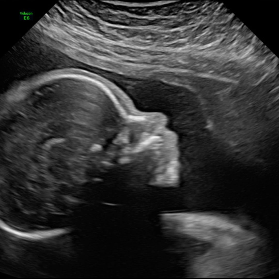 Photo shared by Emily for their Babylist baby registry.