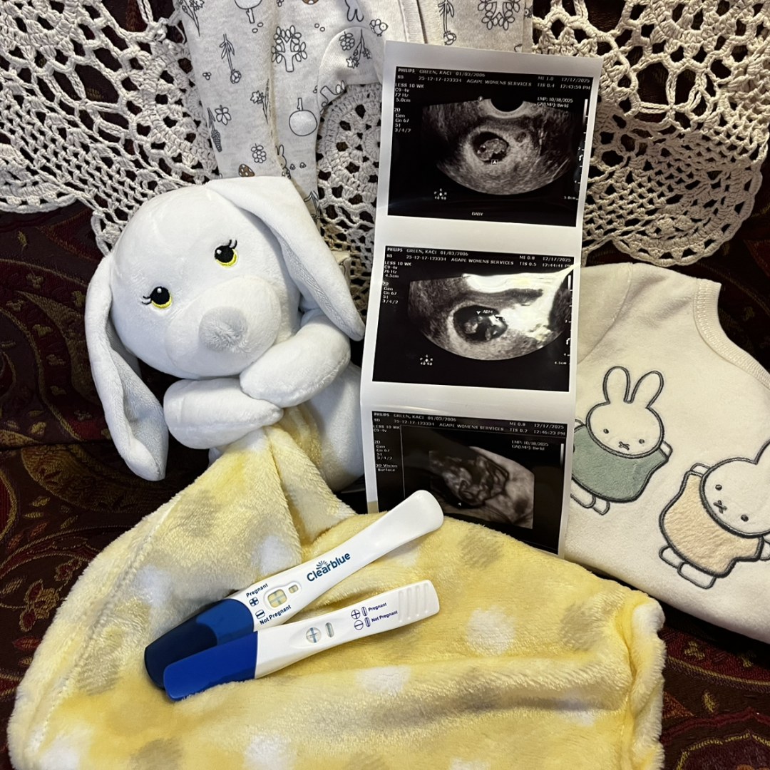 Photo shared by Kaci for their Babylist baby registry.