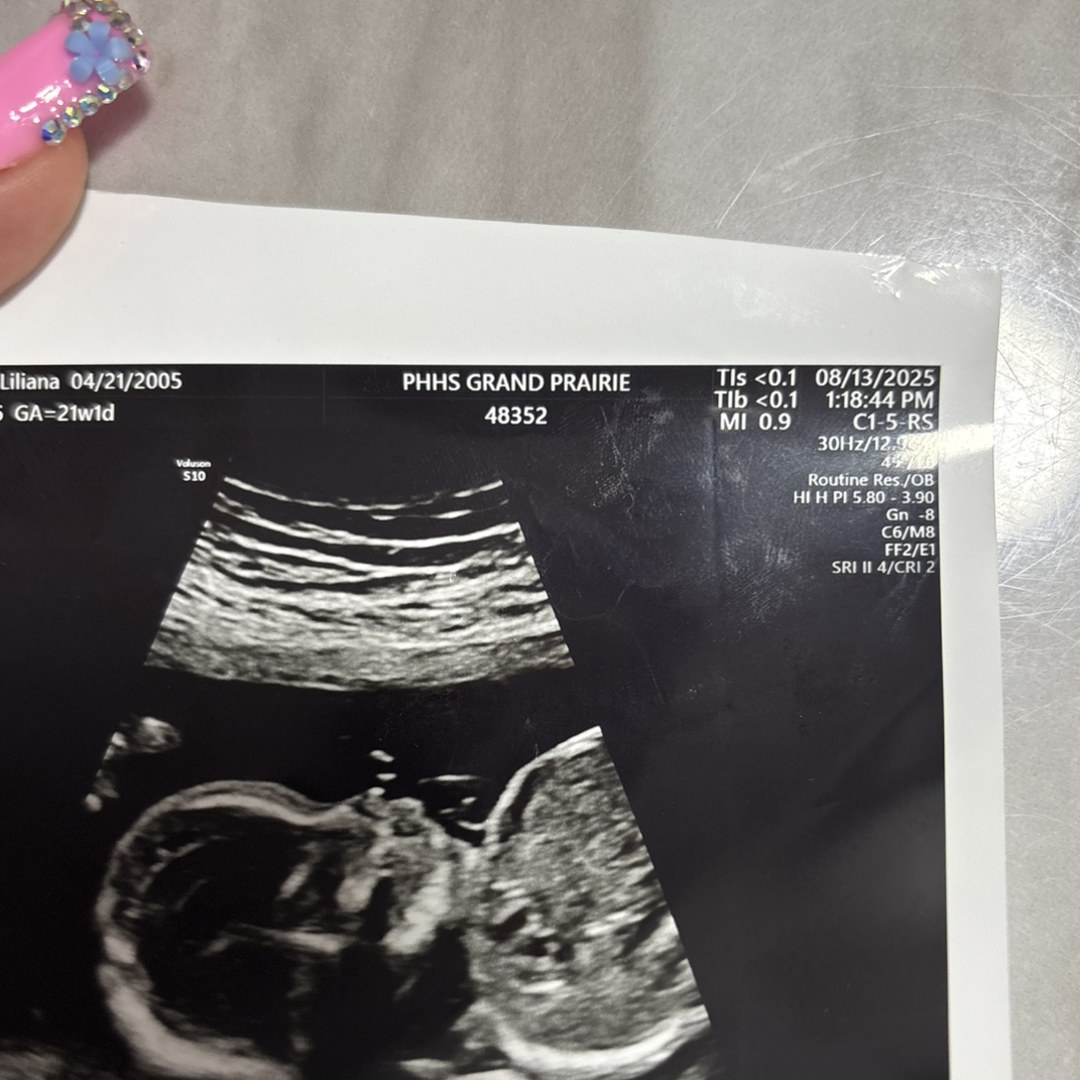 Photo shared by Liliana for their Babylist baby registry.