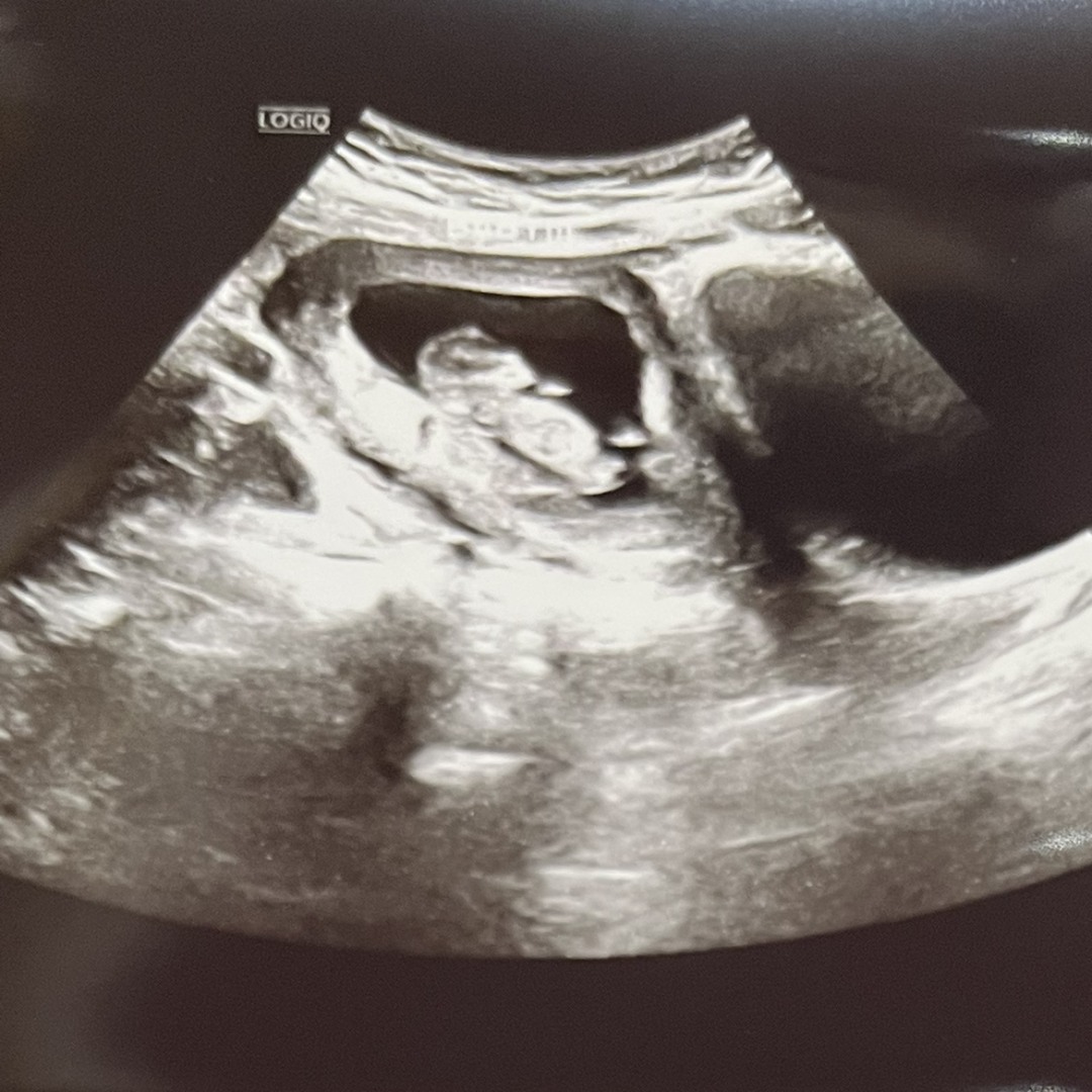 Photo shared by Parker for their Babylist baby registry.