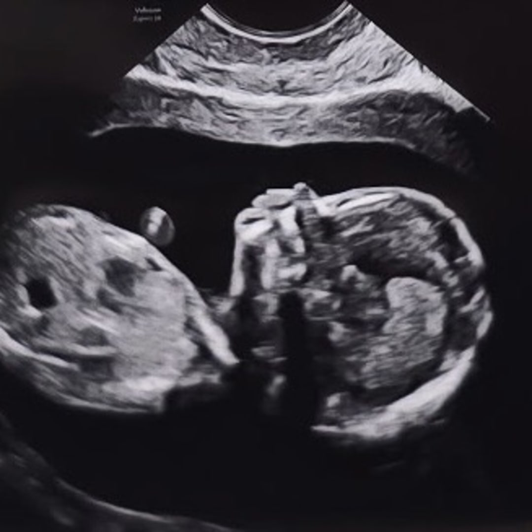 Photo shared by Kyle for their Babylist baby registry.