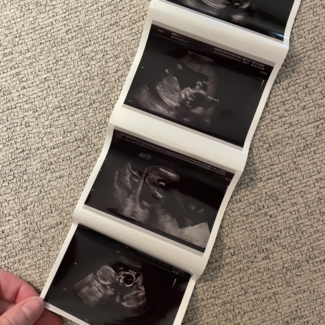 Photo shared by Allison for their Babylist baby registry.