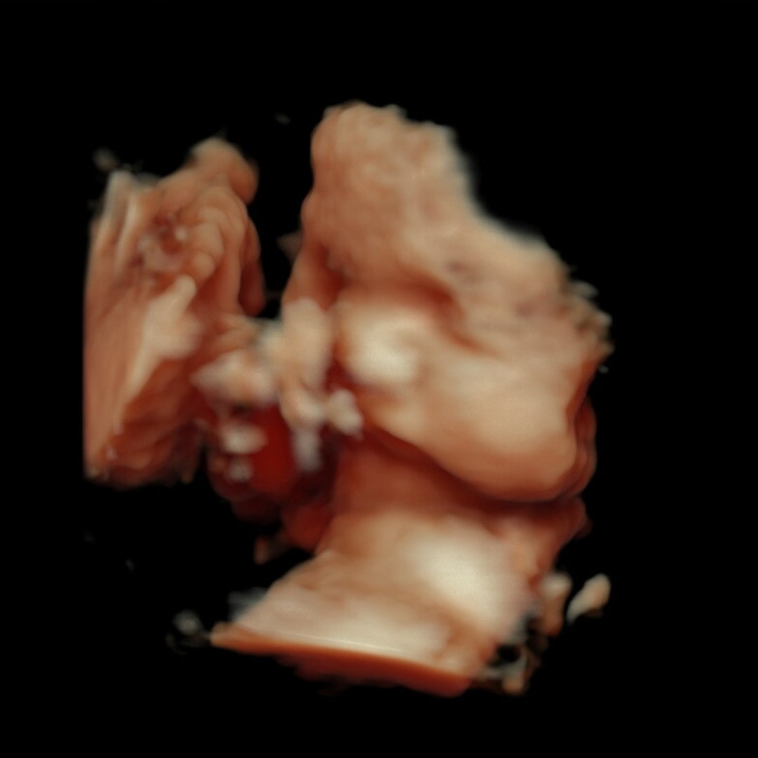 Photo shared by Chantal for their Babylist baby registry.