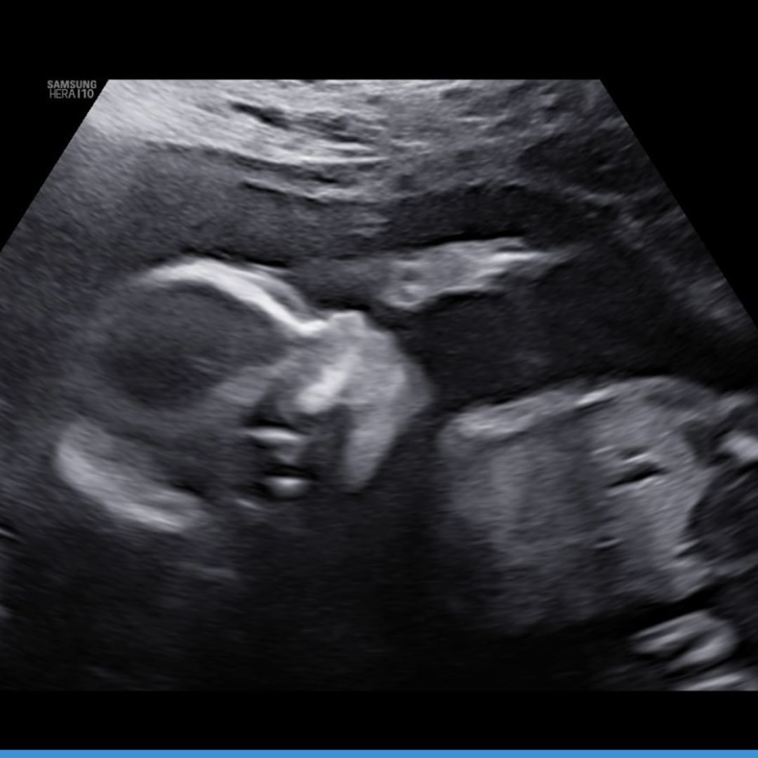 Photo shared by Priscilla for their Babylist baby registry.