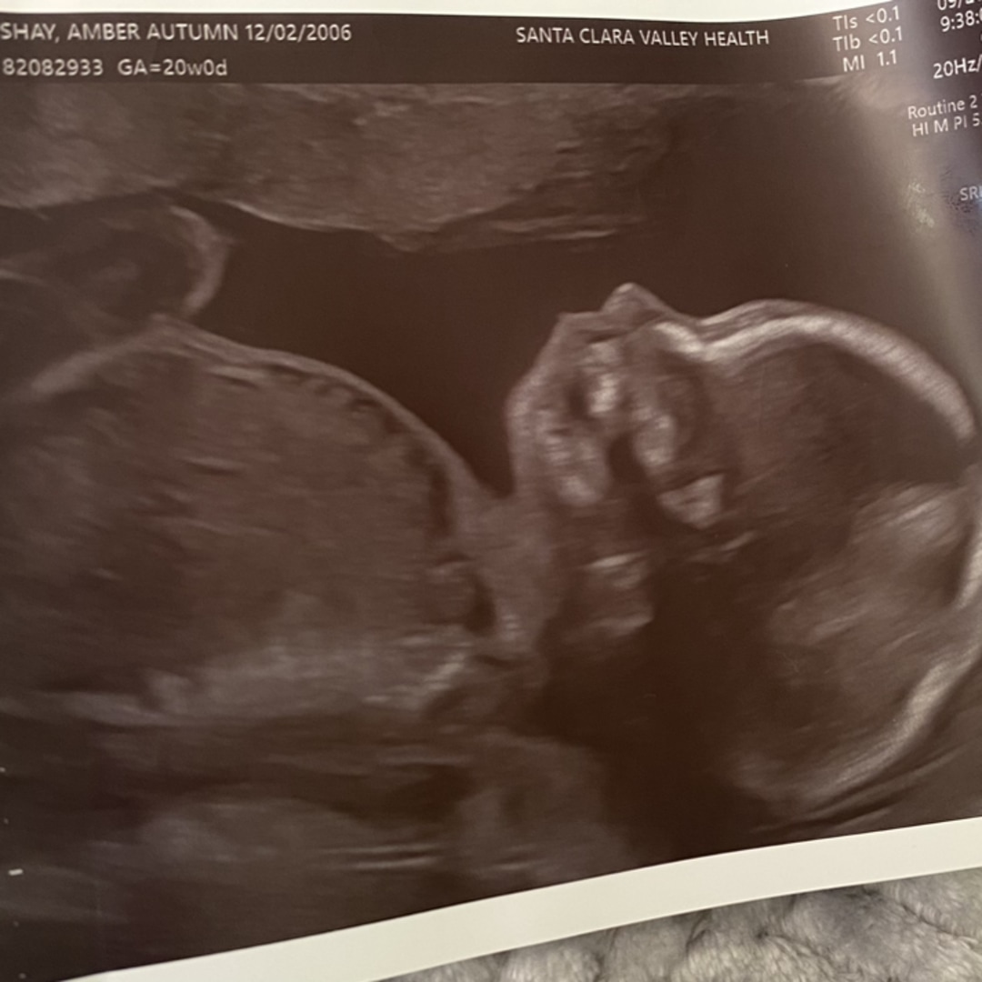 Photo shared by Amber for their Babylist baby registry.