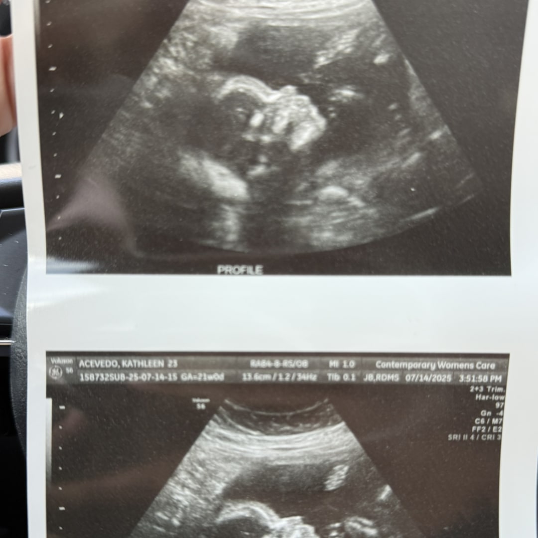 Photo shared by Kathleen for their Babylist baby registry.