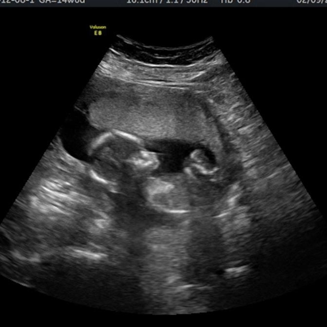 Photo shared by Kiersten for their Babylist baby registry.